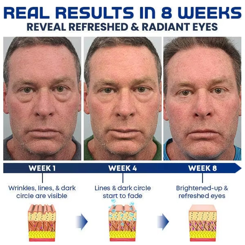 1/2/3/5/10 PCS Lifting Eye Gel, Lifts Firming Eye Tightener Men Eyecream Antiaging