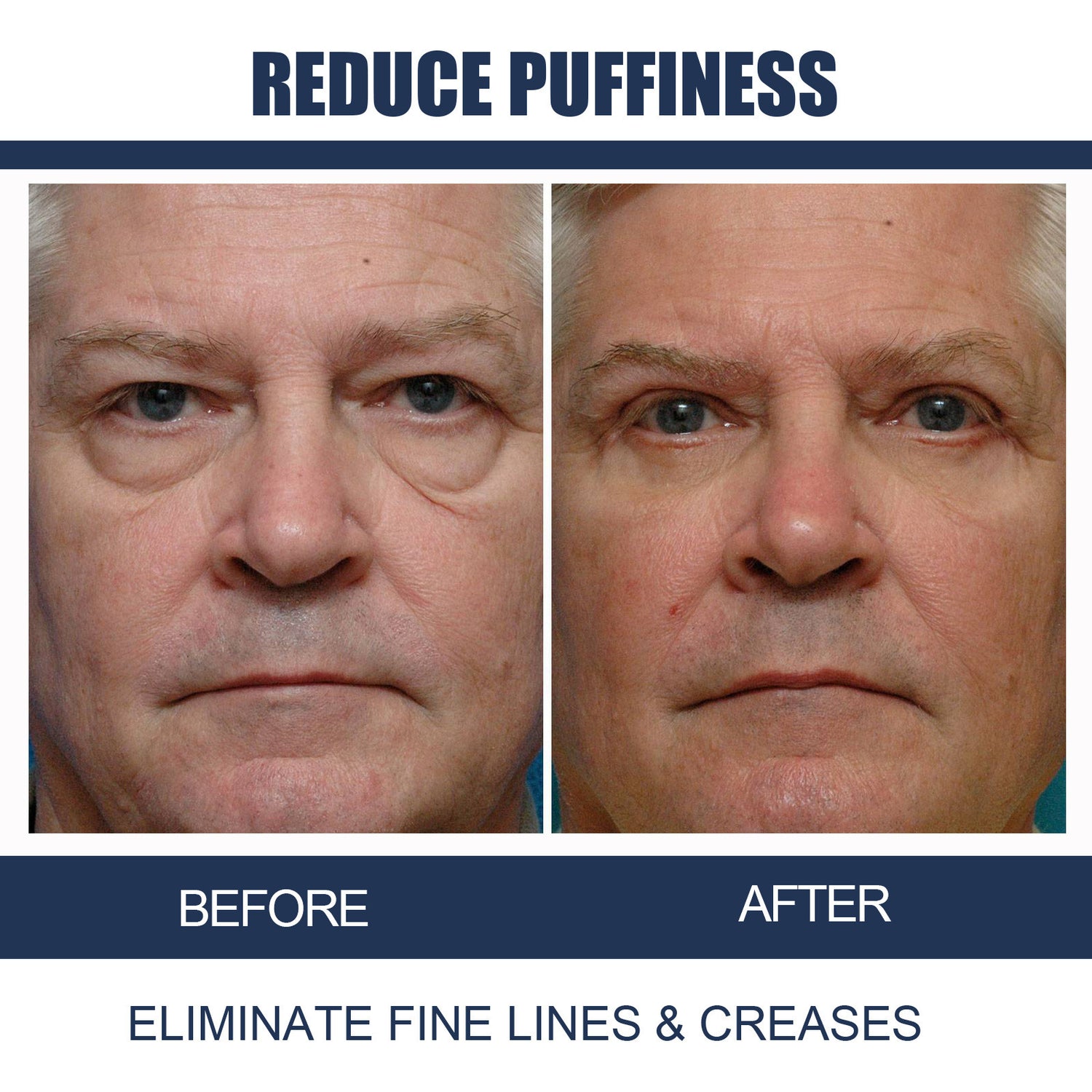 Men'S Anti-Aging Eye Cream